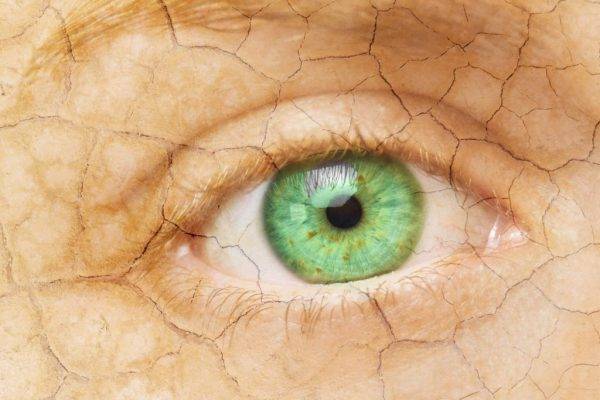 Can an Optometrist Treat Dry Eye? featured image