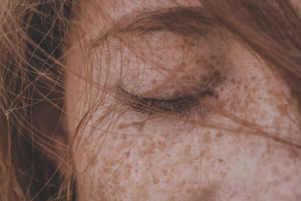 Why Can’t I Fully Close My Eye? featured image