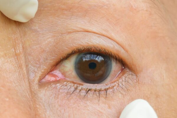 Aging Eyes and Night Vision: Navigating Darkness Safely featured image
