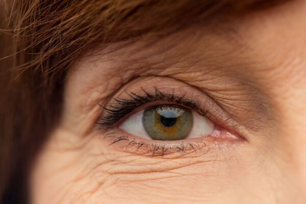 Eye Allergies 101: Managing Symptoms and Finding Relief featured image