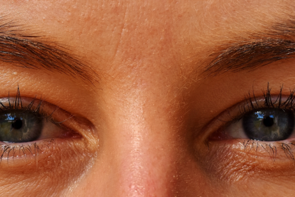 Understanding Common Eye Conditions- A Comprehensive Guide featured image