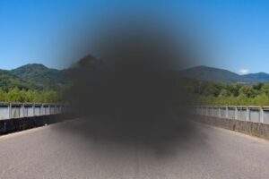 Why is There a Dark Spot in my Central Vision? featured image